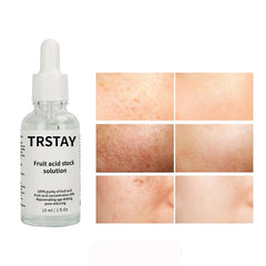 TRSTAY Skin Care Anti-Aging Serum